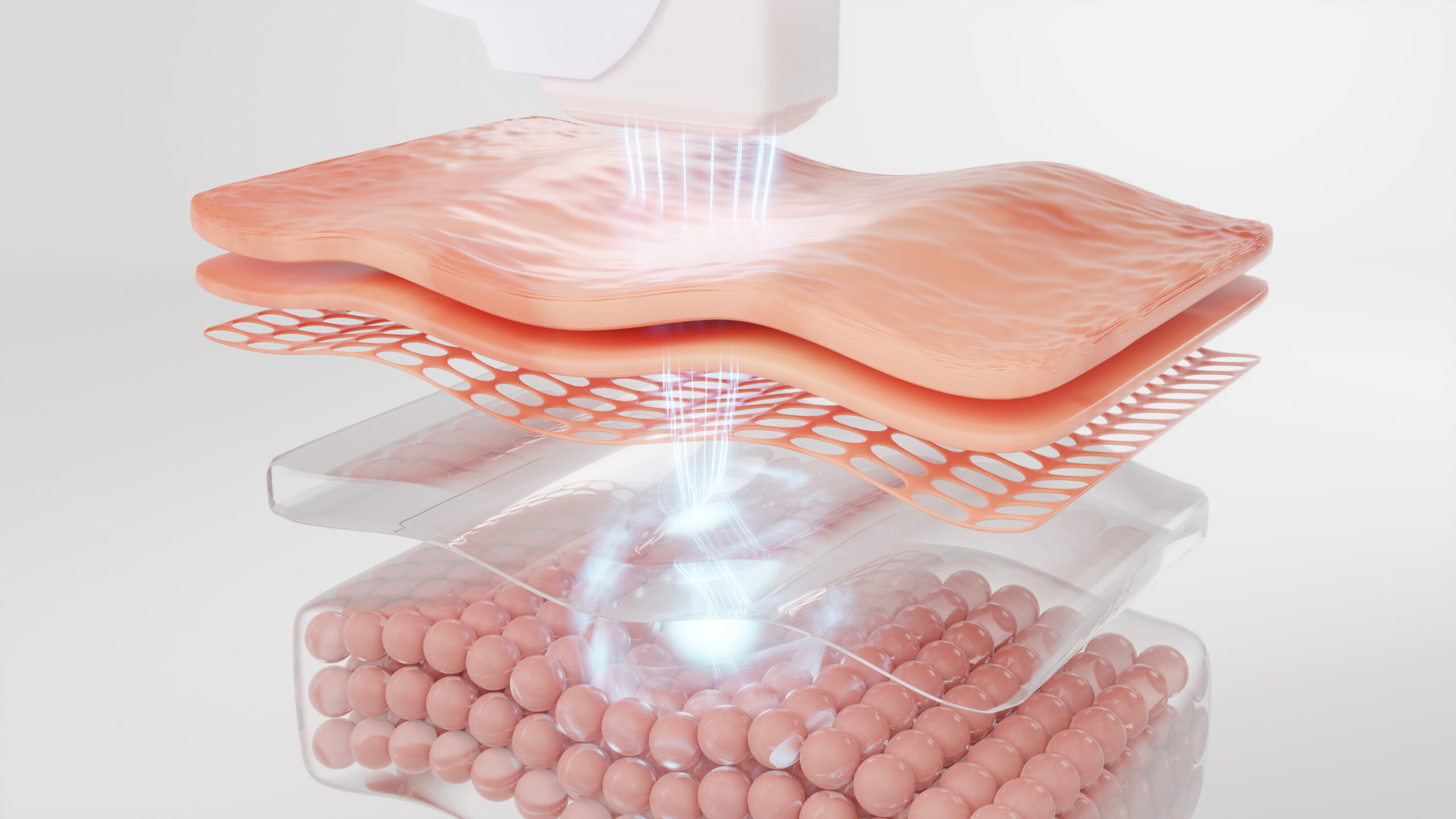 Laser Haarentfernung Essen mit 3D-Darstellung von Hautschichten und gezielten Lichtimpulsen zur hautschonenden Behandlung